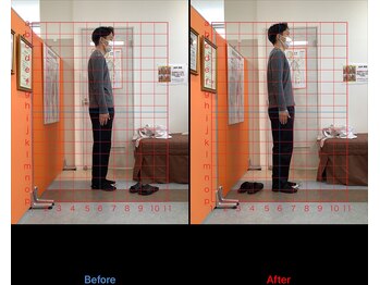 ゼロヒャク整骨院(ZERO100整骨院)/猫背矯正×骨盤矯正