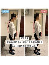 アンティオール 大森本店/Before→After【姿勢改善】