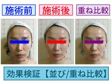 セブンシーズ 上野店(Seven Seas)/【 フェイシャル 】美肌覚醒