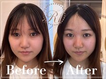 R-1ビューティーサロン 表参道/Before＆After