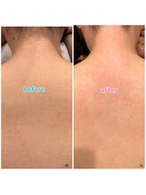 ルーム303(Room303)/背中の時期来ました！#新所沢