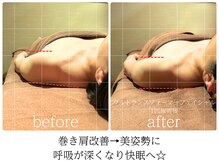 ライフチャージ(Life Charge)/筋膜リリースBefore→After