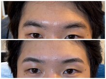 スリーピース(3Peace)/アーチ眉 Before/After