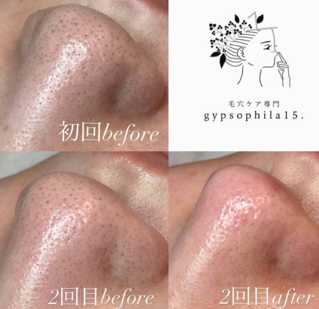 ジプソフィラフィフティドット(gypsophira15.)｜ホットペッパー