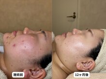 エングラッシー(en glassy)/サブスク月２回コース