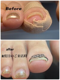 【トラブルフット】