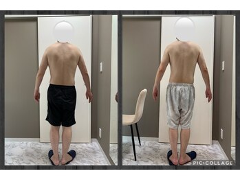 チャロアイト 可部店(Charoite)/メンズ痩身