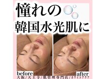 ホワイトカルム(White Calm)の雰囲気（韓国で話題沸騰中!最新☆第4世代『ララピール』で憧れの水光肌に）