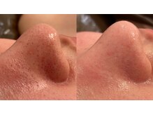 ピーエム(pm)の雰囲気（話題の毛穴ケア◎【原宿/完全個室/ハーブピーリング/毛穴ケア】）