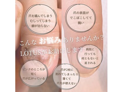 ロータス(LOTUS)の写真