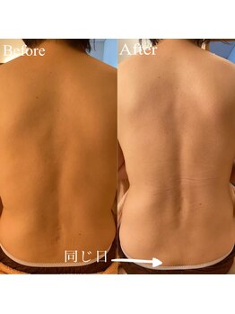 フセヤ &nbsp;エステティックアロマヨガスクール(FUSEYA)/WINBACK ビフォーアフター一宮