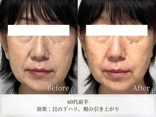 アストリエ グレース 相模大野(Astorie Grace)/1回でもリフトアップ！