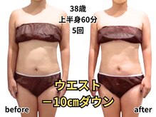 アルピナ(ALPINA)/上半身サイズダウン例