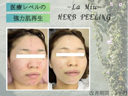 ラミーユ(La Miu)の写真