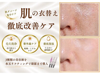 ジヒカ(ZIHICA)の写真