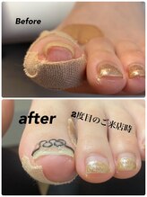 モアニヒロオ 広尾駅前店(MOANI Hiroo)/【トラブルフット】