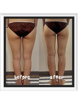 ソワン(soin)/ ★結果重視のサイズダウン★