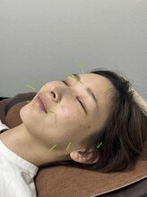 かなざわ鍼灸院/