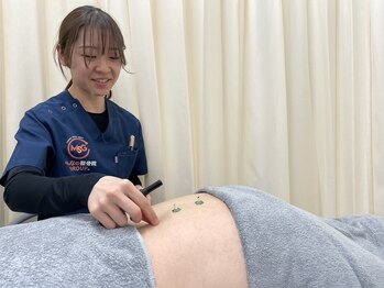 谷塚駅前整骨院/鍼灸施術も行っております。