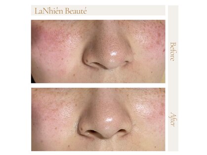 ラニィエンボーテ(La Nhien Beaute)の写真