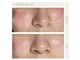 ラニィエンボーテ(La Nhien Beaute)の写真