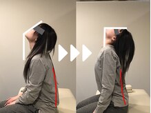 ミライズ整体院 三宮本院/事例【20代女性・首こり】