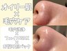 【再来】全顔毛も取れる毛穴洗浄♪フェイスWAX脱毛+毛穴洗浄+お悩み別pack