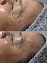 トモニ(TOMONI)/肌質改善サロン　TOMONI