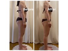 シェリマ 西新宿(cheri.ma)の雰囲気（置きっぱなし脂肪を全身徹底ケア見た目を変えたい方に◎）