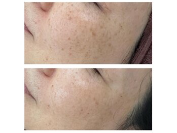 てぃーだ/まずはカウンセリングから!