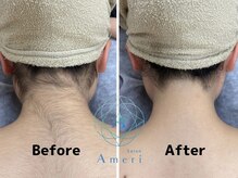 サロンアメリ 高知駅前店(Salon Ameri)の雰囲気（違いが分かるサロン、私たちが必ず結果でお応えします♪ ）