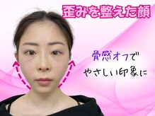 ナチュラルパーフェクトフェイス 新宿/歪みを整えた顔