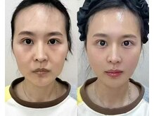 シホン 博多(SHIHON)/