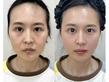 シホン 博多(SHIHON)/