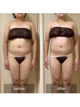 ココカラ(COCOKARA)/インディバ/アロマ　痩せ