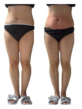 ララナ バイ カノア(LALANA by kanoa)/お腹すっきり！