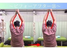 ケアるら整骨院 富里院/ビフォーアフター