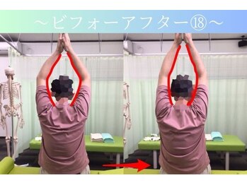 ケアるら整骨院 富里院/ビフォーアフター