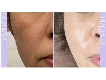 リラクゼーションサロン ラキ(laki)/スキンメイド/トロイアルケ