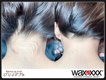ブリリアント/うなじwax脱毛