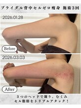 シーフェイス 横浜店(SEE FACE)/横浜駅近ブライダル痩身エステ