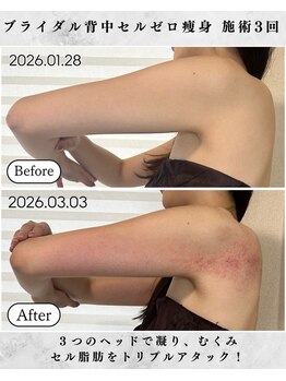 シーフェイス 横浜店(SEE FACE)/横浜駅近ブライダル痩身エステ