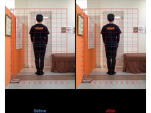 ゼロヒャク整骨院(ZERO100整骨院)/猫背矯正×骨盤矯正×鍼灸