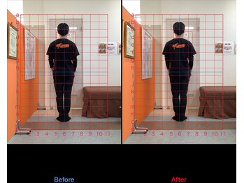 ゼロヒャク整骨院(ZERO100整骨院)/猫背矯正×骨盤矯正×鍼灸