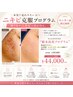 【モニター】ニキビ克服プログラム通常99,000→初回のみモニター価格44,000