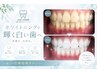 【お試し｜美容セルフホワイトニング】1回4～5トーンUP!(15分x2回照射)