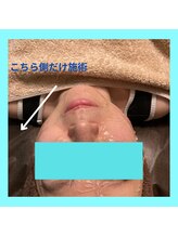 ラ シルク(La silk)/フェイシャル