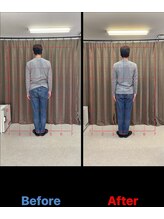 整体院ビーティーラボ(B.T Labo)/姿勢・骨盤調整