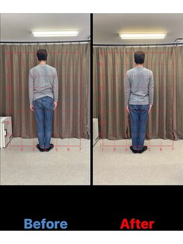 整体院ビーティーラボ(B.T Labo)/姿勢・骨盤調整