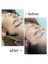 アプ(APP.)/通い続ける事で肌変化あり◎眉毛